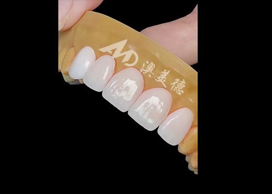 Buen precio Coronas dentales de zirconia de precisión para una restauración natural y duradera en línea