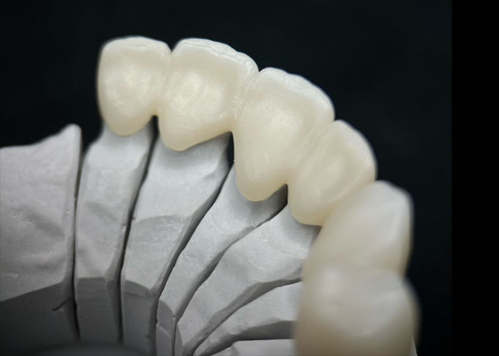 Buen precio Una corona dental de zircónia sólida que ofrece una resistencia excepcional y una estética natural en línea