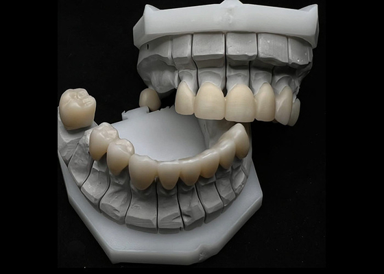 Buen precio Resistencia a las roturas de la corona dental de zirconia para dientes simples o múltiples en línea