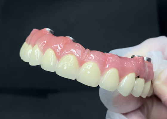 Buen precio Implantes dentales duraderos con una base de titanio fácil de limpiar y una corona de zirconio en línea