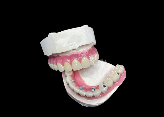 Buen precio Implante dental de zirconia, puente de corona en el 6 para reemplazo de dientes perdidos. en línea
