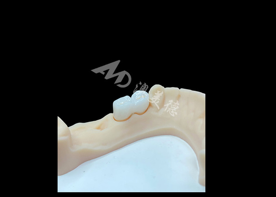 Buen precio Una corona sólida de zirconio de alta calidad para restauraciones dentales satisfactorias en línea
