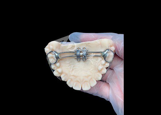 Buen precio MSE expansor palatino Aplicaciones ortodoncistas innovadoras para una alineación efectiva de los dientes en línea
