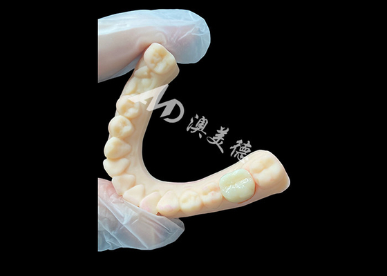 Buen precio Coronilla dental posterior de cerámica de zirconia de alta resistencia Estética y durabilidad superiores en línea