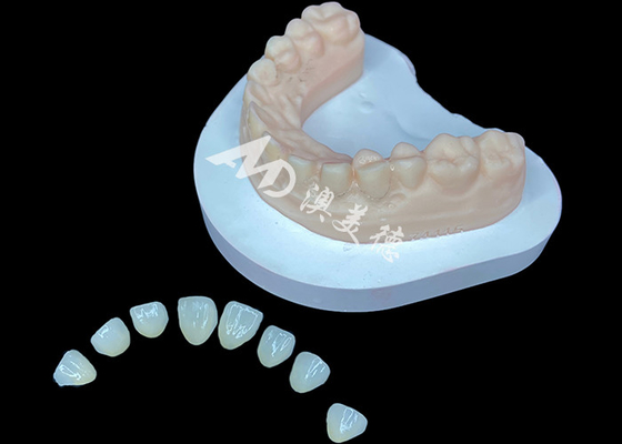 Buen precio IPS e.max Veneer Solución estética premium para transformaciones de sonrisa impresionantes en línea