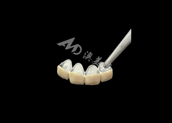 Buen precio Porcelana fundida en corona de metal con mayor resistencia a la corrosión en línea