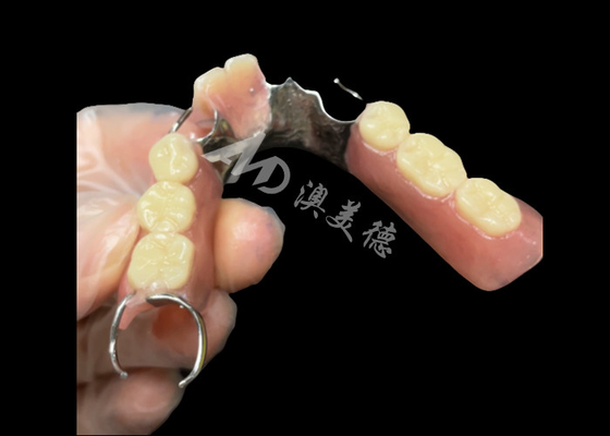 Buen precio Dentaduras parciales de titanio fundido con abrazaderas en línea