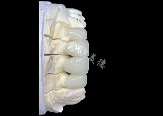 Buen precio Puente de corona de cerámica de zirconio de aspecto natural proporciona precisión y estética combinadas en línea