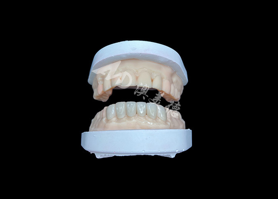 Buen precio IPS Emax Veneers Restauración de aspecto natural para sonrisas estéticas en línea