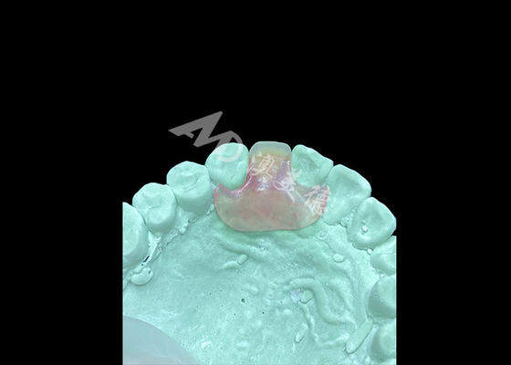 Buen precio Dentadura flexible Nesbit ligera y cómoda para reemplazo de un solo diente en línea