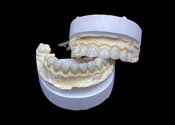 Buen precio Personalización Veneces de vidrio cerámico ultra delgado de alta transparencia para una sonrisa natural en línea