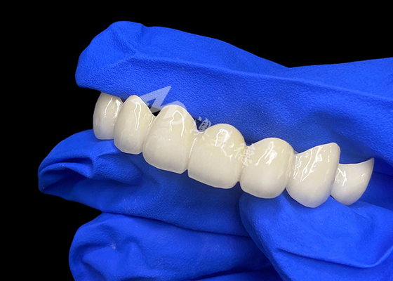Buen precio Puente dental de zirconia de lava de alta translucidez mezcla sin costuras con dientes naturales en línea