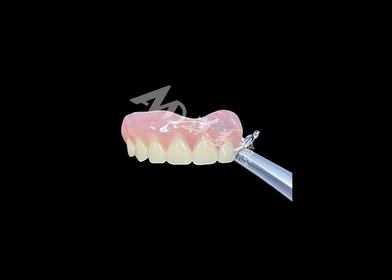 Buen precio Dentadura parcial fácil de colocar restaura la capacidad de masticar y hablar en línea