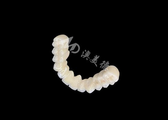 Buen precio Ponte de corona dental PFM con excelente biocompatibilidad en línea