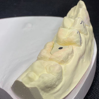 Buen precio Reinforce Your Restoration with Lock Pink Post Core Technology en línea