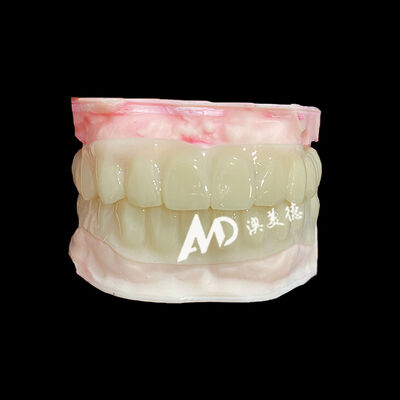Buen precio PMMA Hollow Temporary Bridges for Implant Provisional Cases en línea