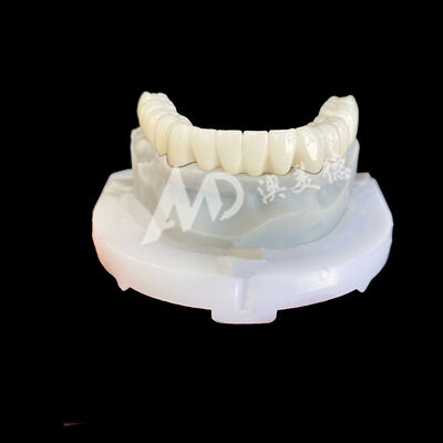Buen precio Corona dental de zirconia: corona de porcelana de alta resistencia para una durabilidad duradera con tono B1 en línea