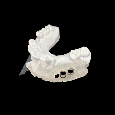 Buen precio Guía de implantes quirúrgicos impresos en 3D de ajuste preciso con alta resistencia a la decoloración utilizando tecnología de fresado CAD / CAM en línea