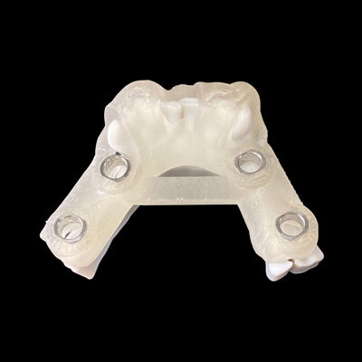 Buen precio Guía quirúrgica de implantes digital con informe de planificación de implantes en línea