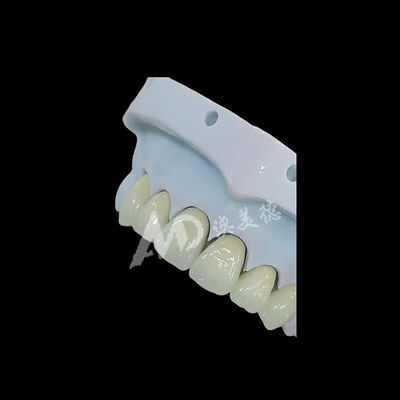 Buen precio Coronilla dental de zirconia monolítica de contorno completo En línea